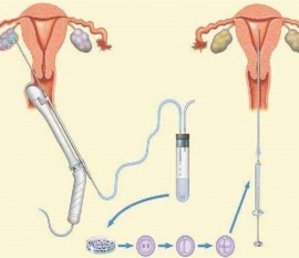 35岁女性备孕请做好以下检查，“健康常州代生宝宝”跑不远